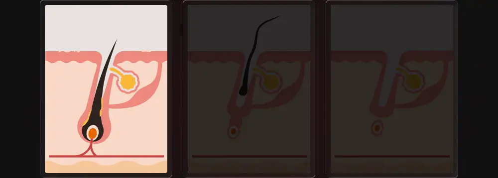 [포켓몬 에디션][비듬/각질케어]릴리이브 스칼프턴 시카 PDRN 딥클린 샴푸 500g 2종 택1 상세페이지 24